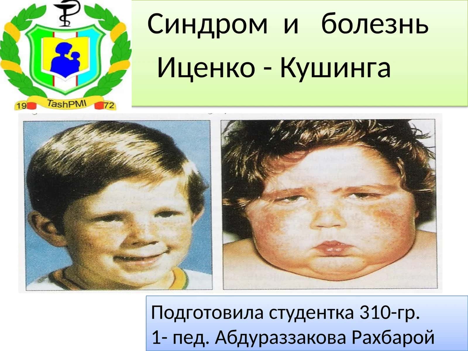 Иценко-Кушинга