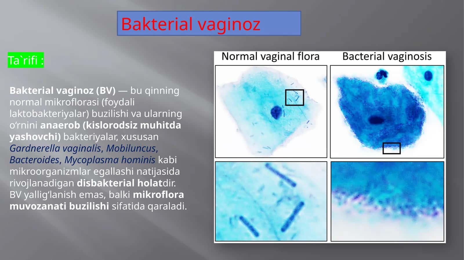Bakterial vaginoz