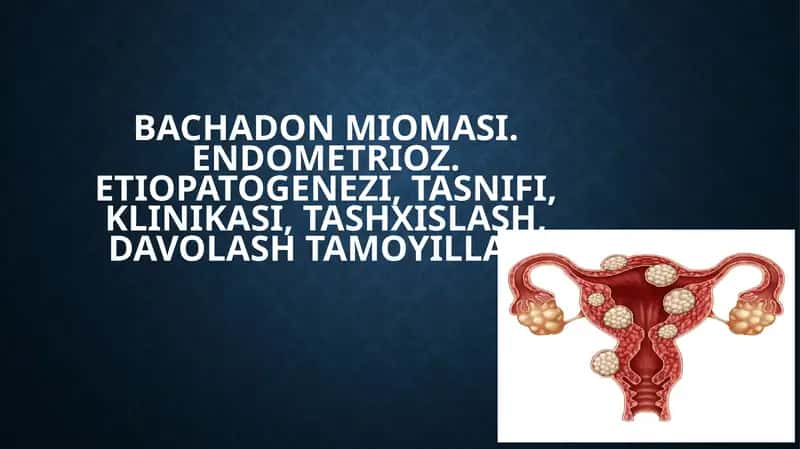 Bachadonmiomasi
