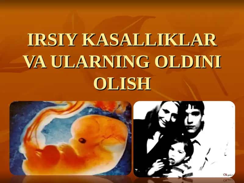 IRSIY KASALLIKLAR VA ULARNING OLDINI OLISH