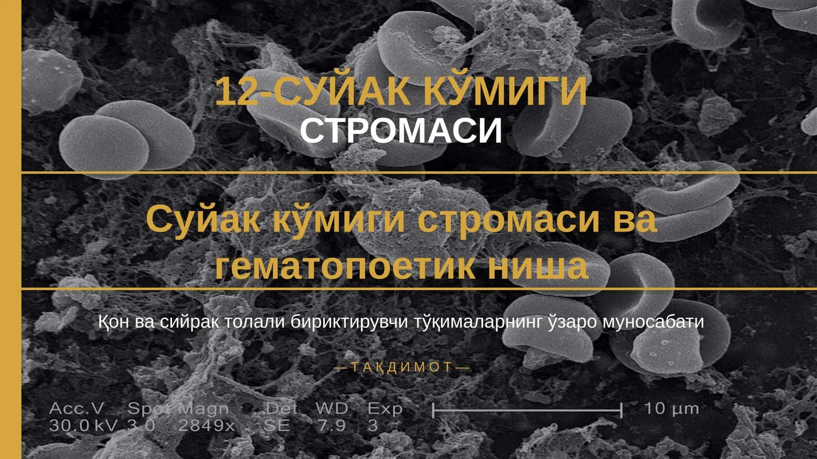 12-СУЙАК КЎМИГИ