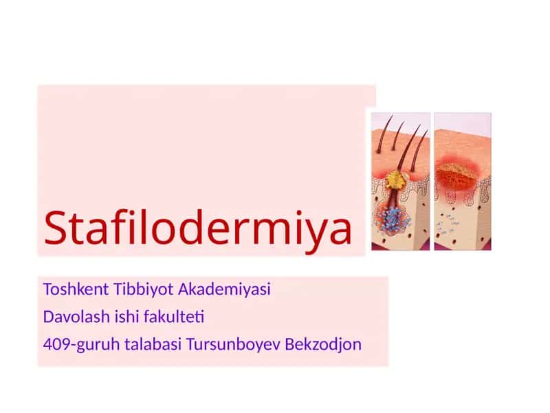 Stafilodermiya