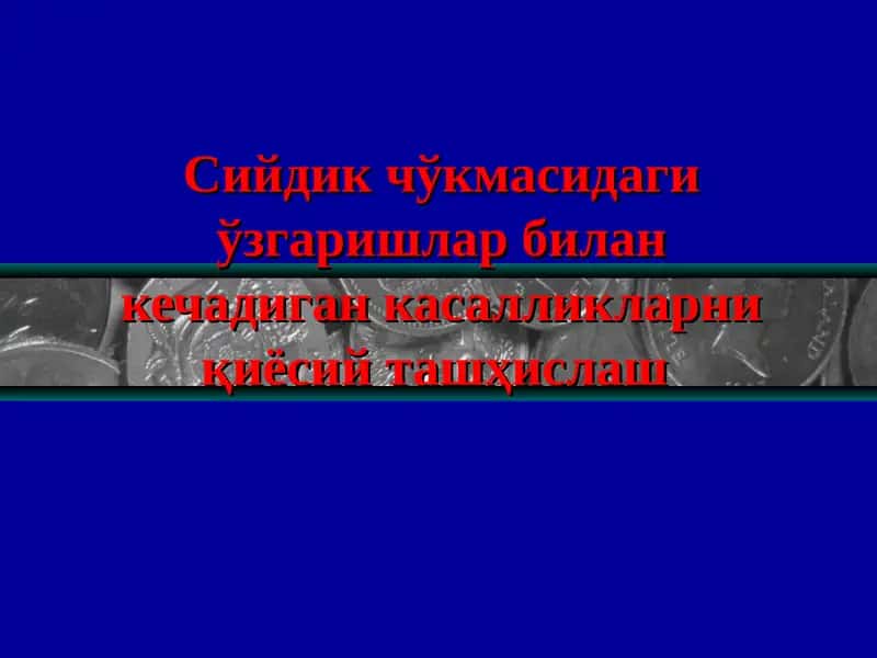 Сийдик чўкмасидаги ўзгаришлар билан кечадиган касалликлар