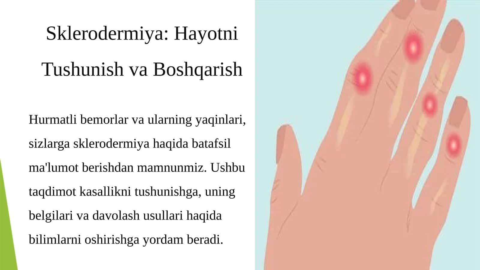 Sklerodermiya: Hayotni Tushunish va Boshqarish