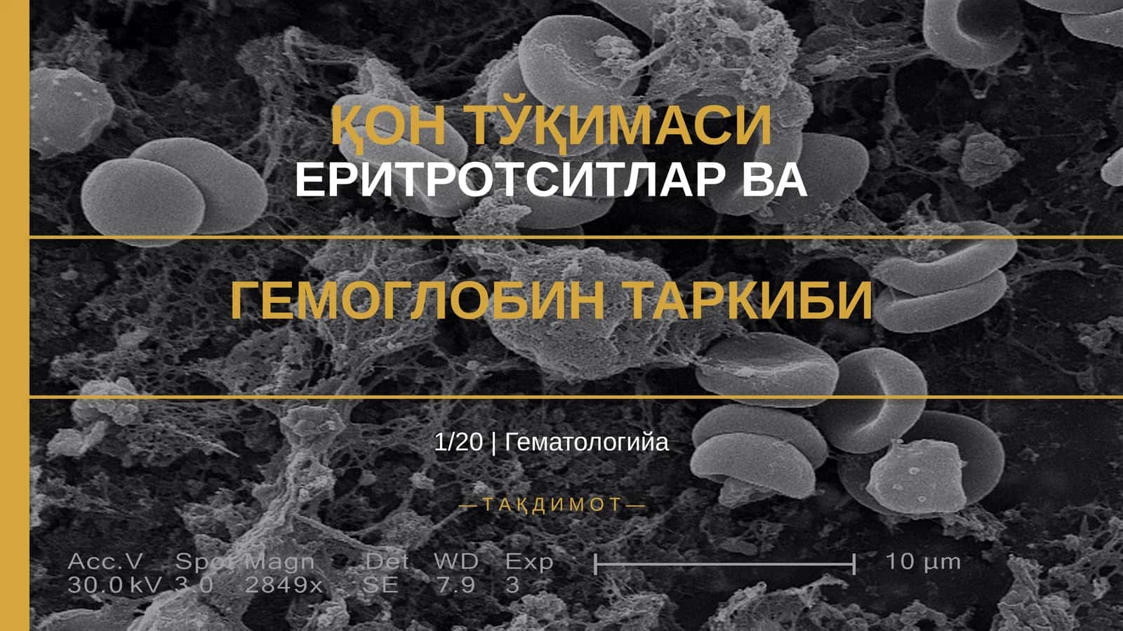 ҚОН ТЎҚИМАСИ