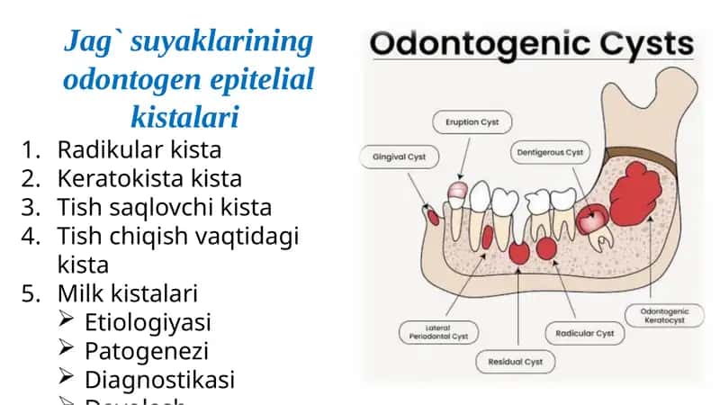 Jag`suyaklarining odontogen epitelial kistalari