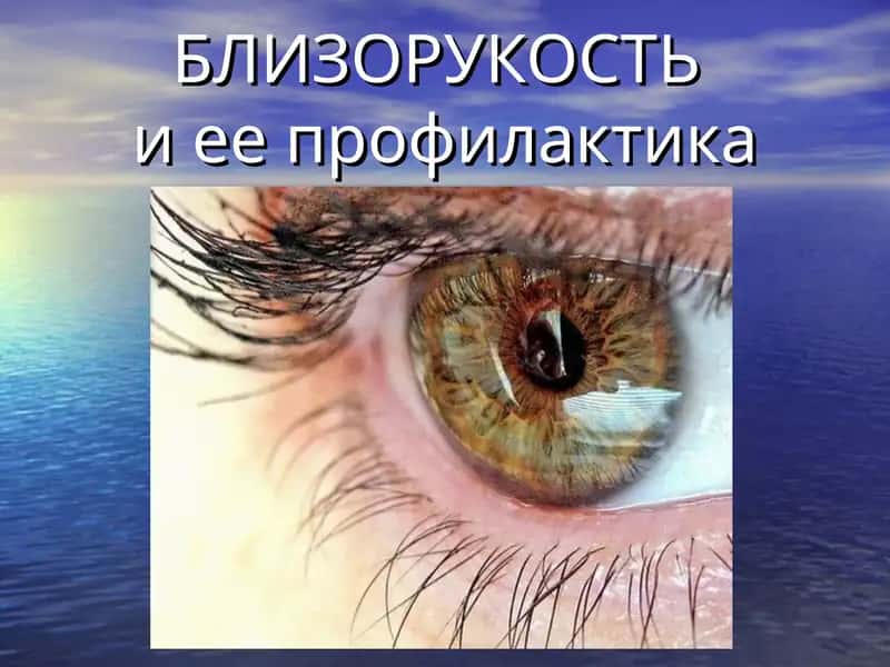 Близорукостьи ее профилактика