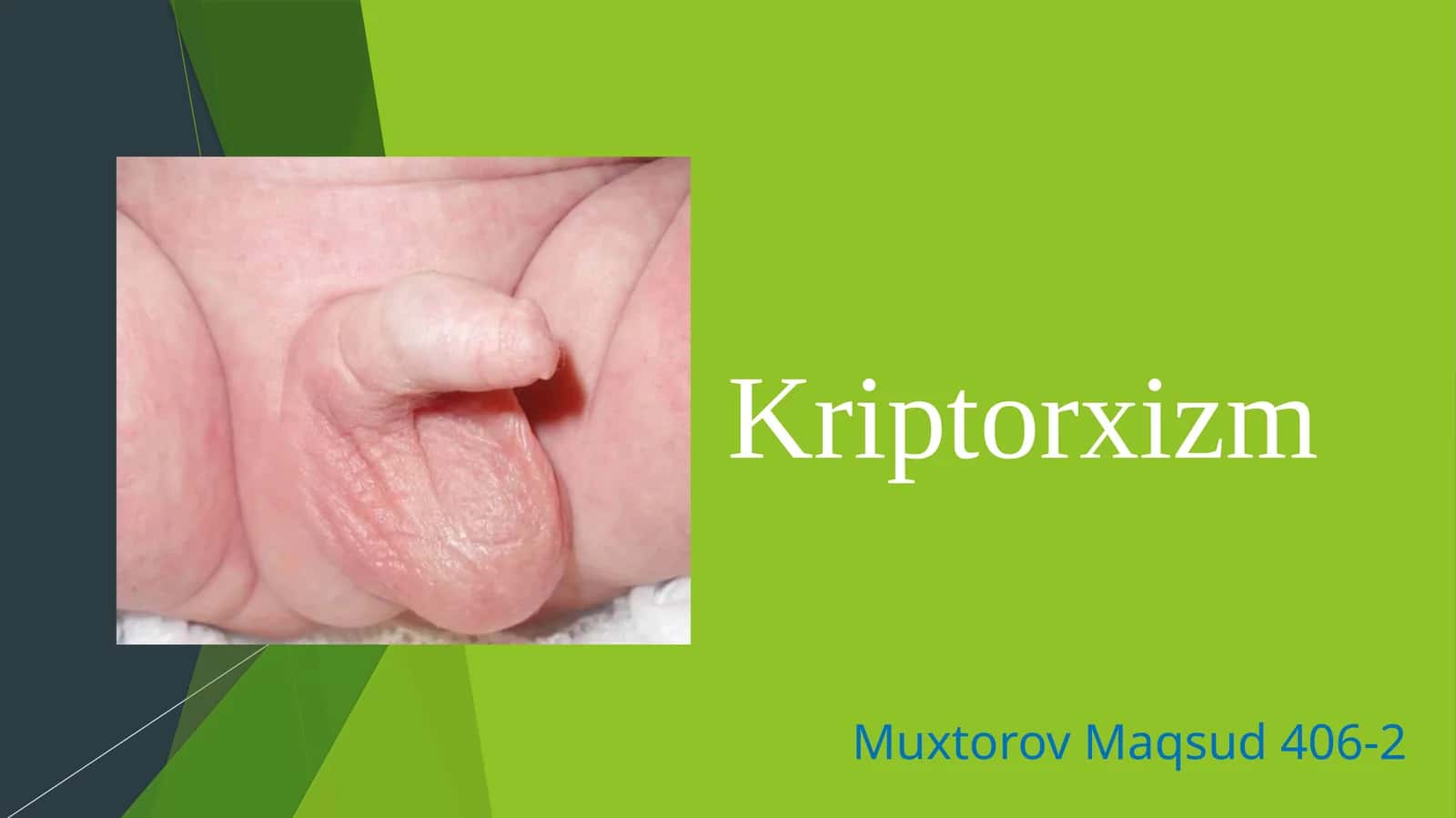 Kriptorxizm