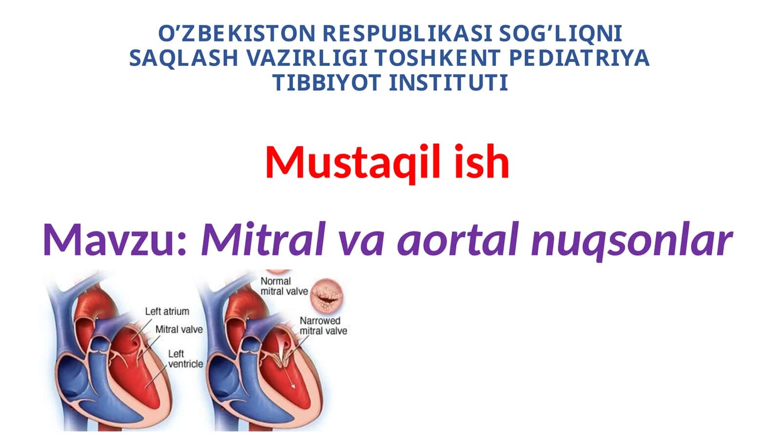 Ortirilgan yurak nuqsonlari. Mitral va aortal nuqsonlar