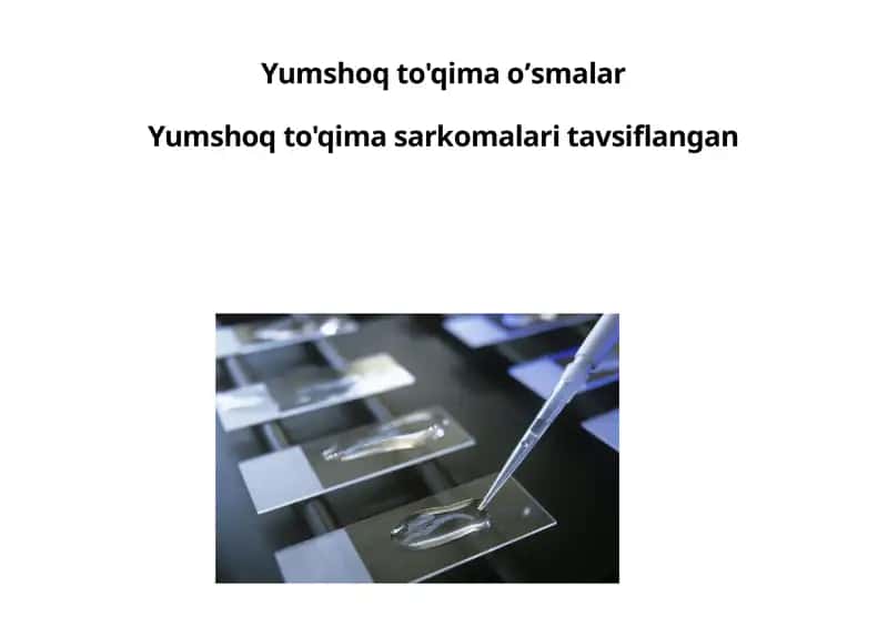 Yumshoq to'qimalar sarkomlari