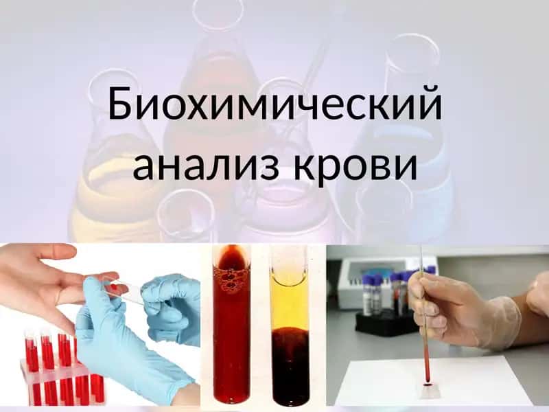 Биохимический анализ крови