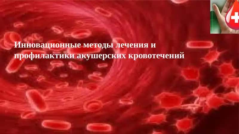 Инновационные методы лечения и профилактики акушерских кровотечений