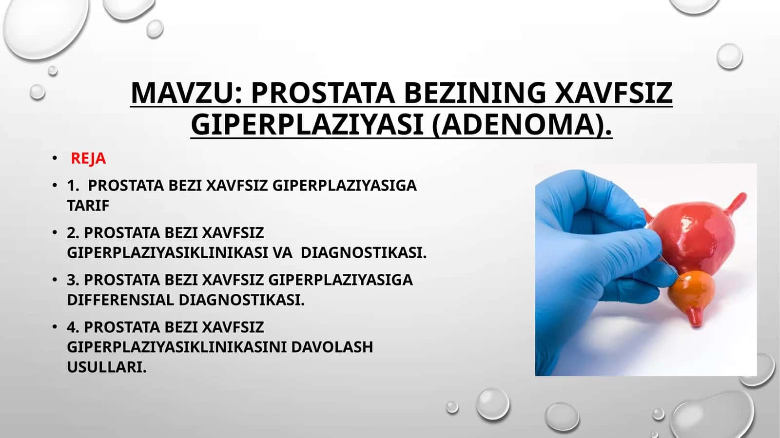Prostatabezining xavfsiz giperplaziyasi (adenoma)