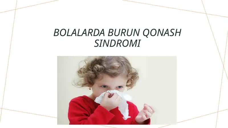 Bolalarda burun qonash sindromi