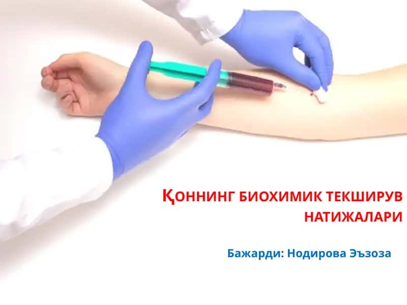 Қоннинг биохимиктекширув натижалари