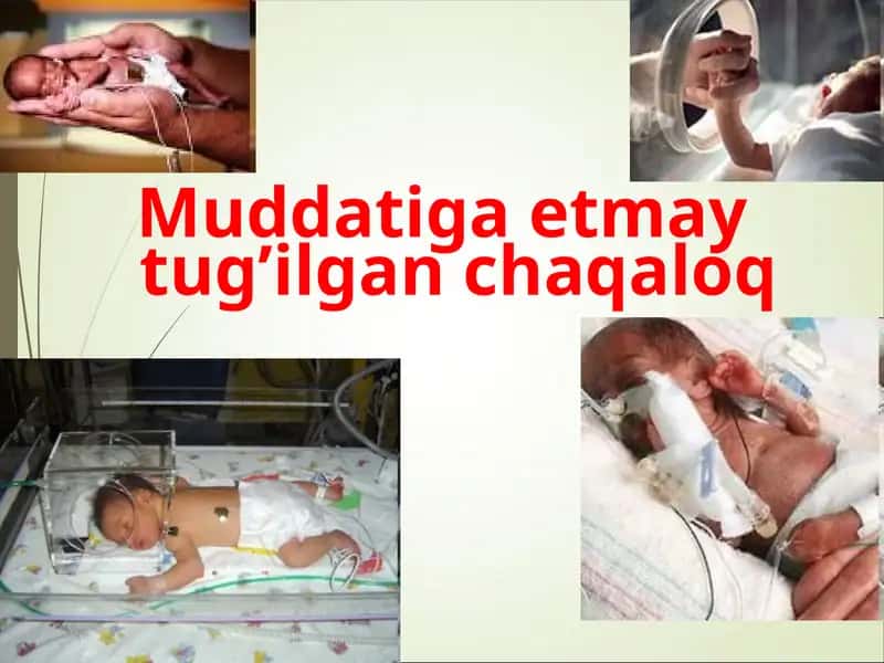 Muddatiga etmay tug’ilgan chaqaloq