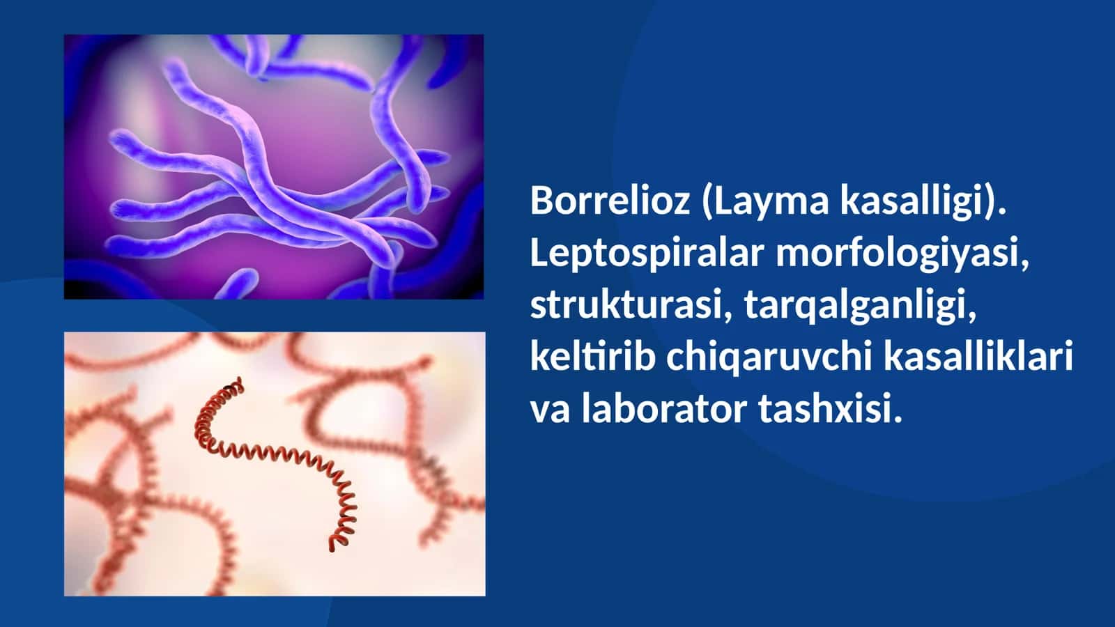 Borrelioz (Layma kasalligi). Leptospiralar morfologiyasi, strukturasi, tarqalganligi, keltirib chiqaruvchi kasalliklari va laborator tashxisi
