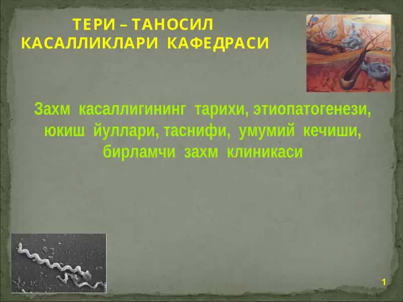 Таносил касалликлари