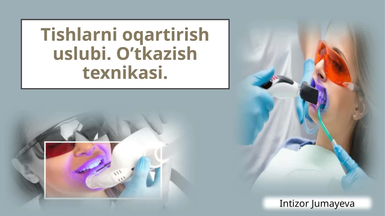 Tishlarni oqartirish usullari