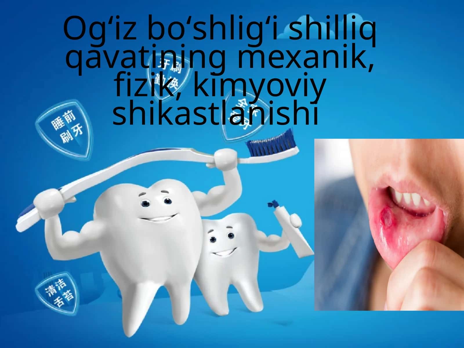 Ogʻiz boʻshligʻi shilliq qavatining mexanik, fizik, kimyoviy shikastlanishi
