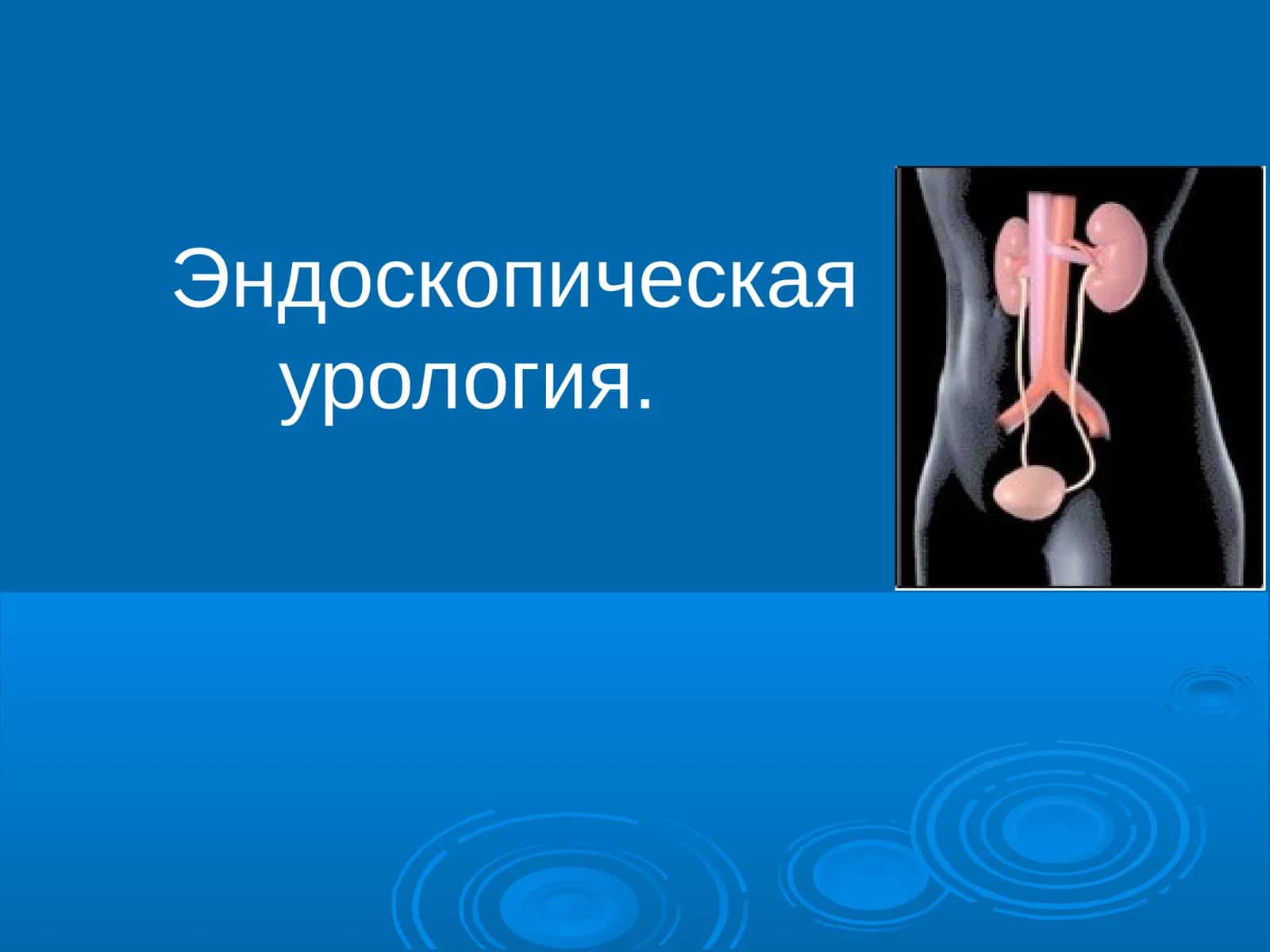 Эндоскопическая урология. Инструментальная урология