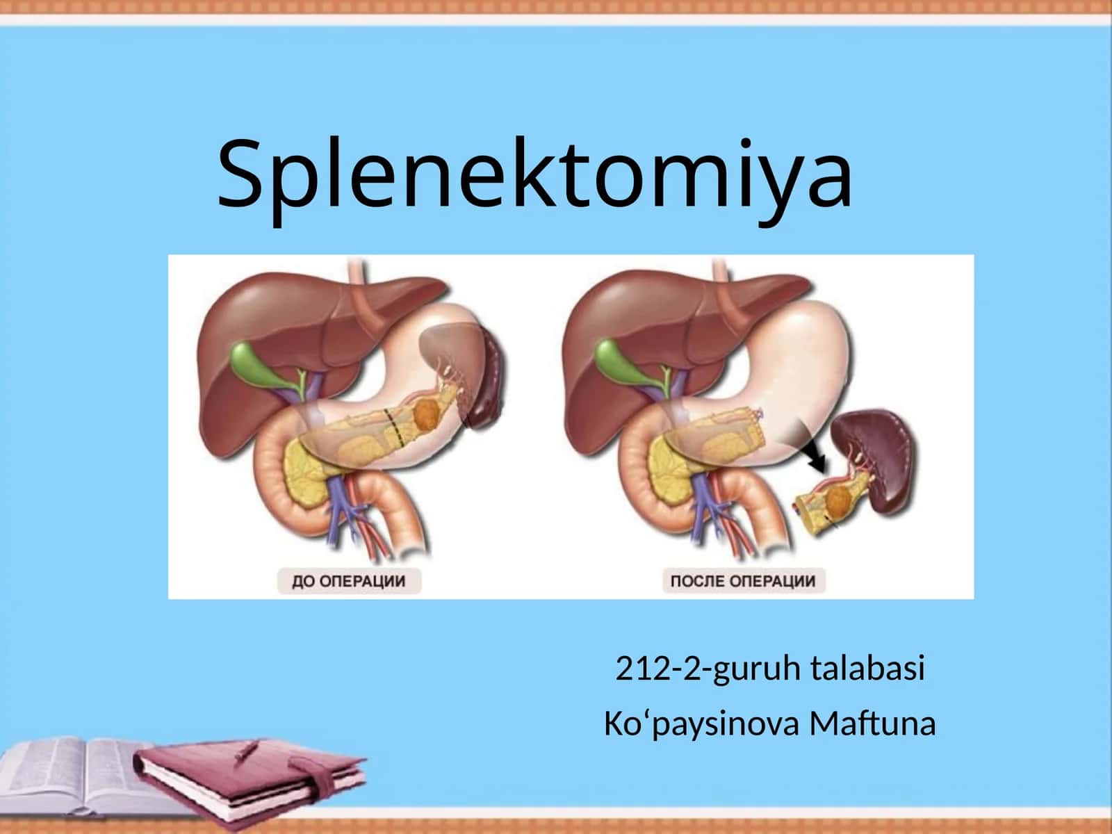 Splenektomiya