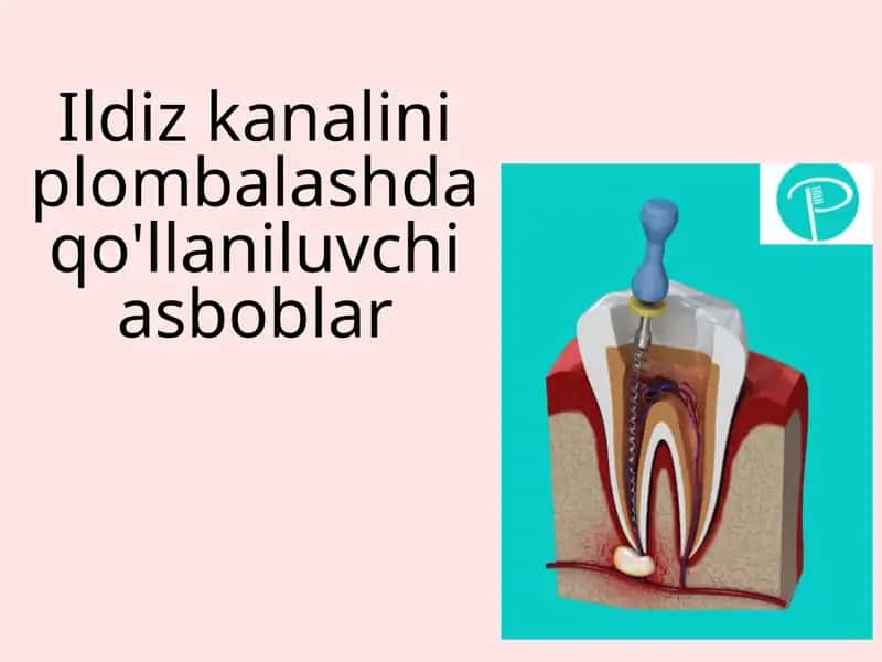 Ildiz kanalini plombalashda qo'llaniluvchi asboblar