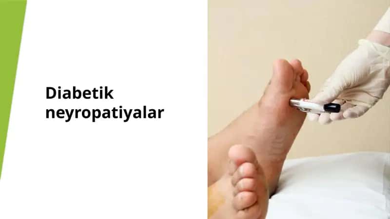 Diabetik neyropatiyalar