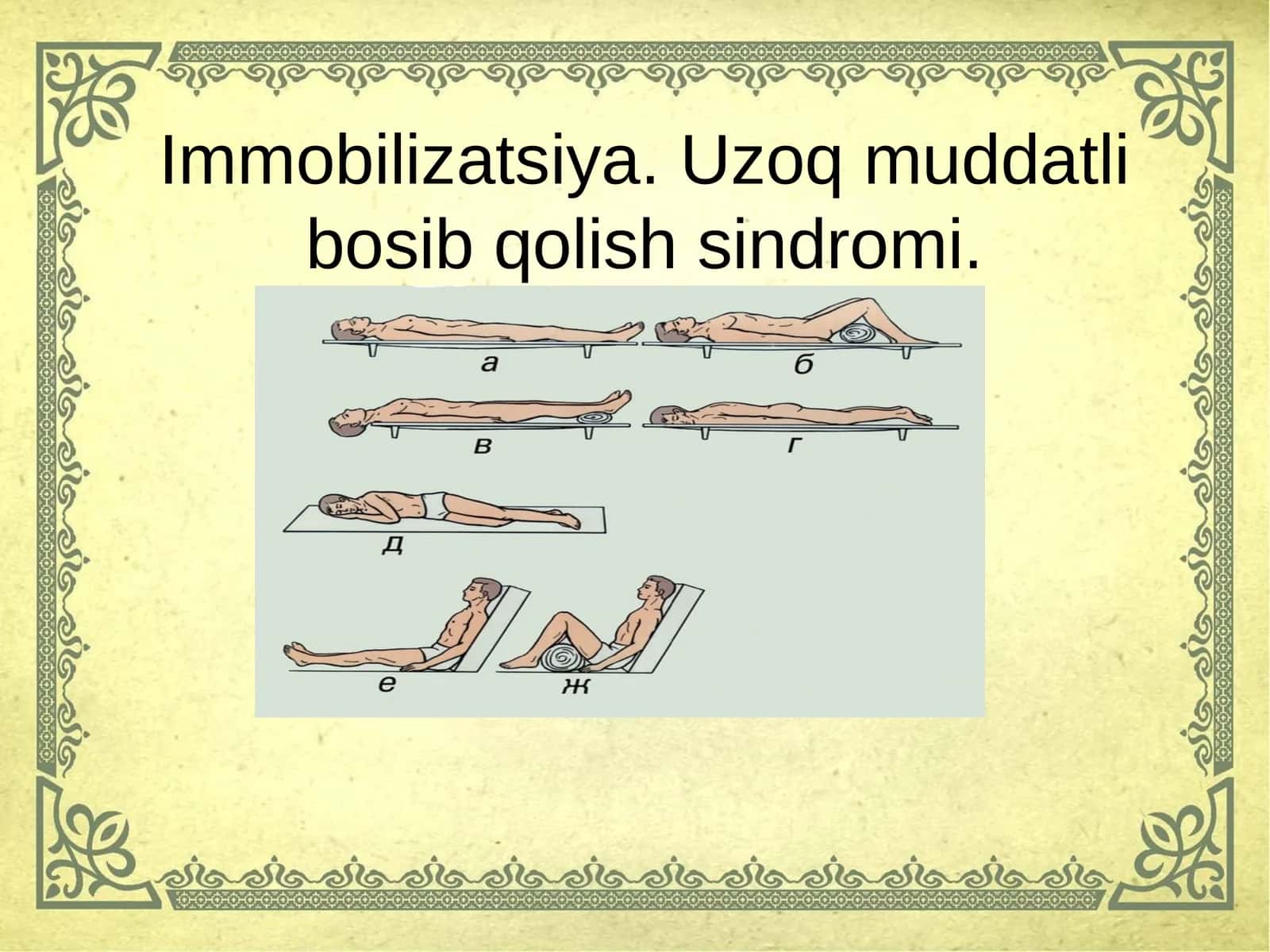 Immobilizatsiya.Uzoq muddatli bosib qolish sindromi