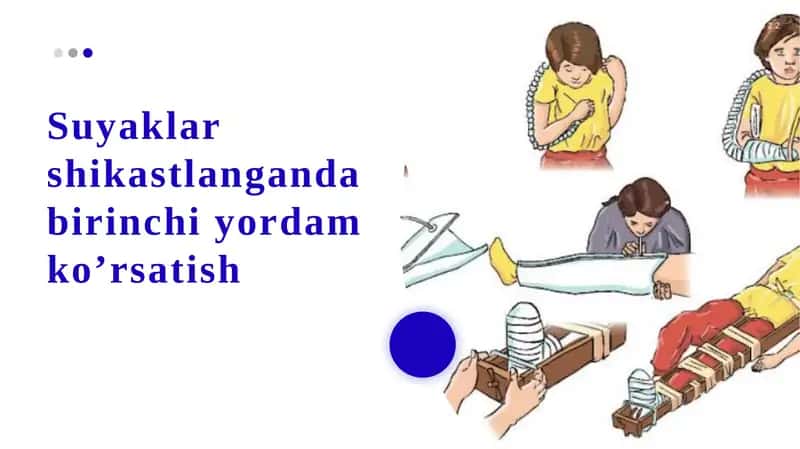 Suyaklar shikastlanganida birinchi yordam ko’rsatish