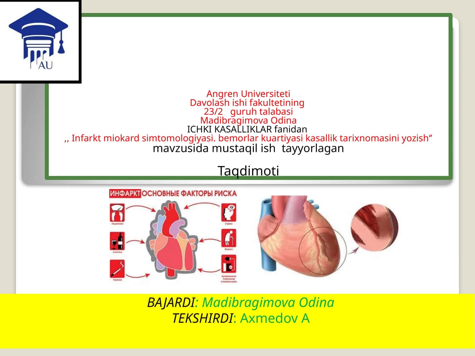 Infarkt miokard simtomologiyasi