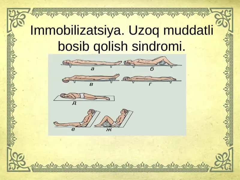 Immobilizatsiya.Uzoq muddatli bosib qolish sindromi