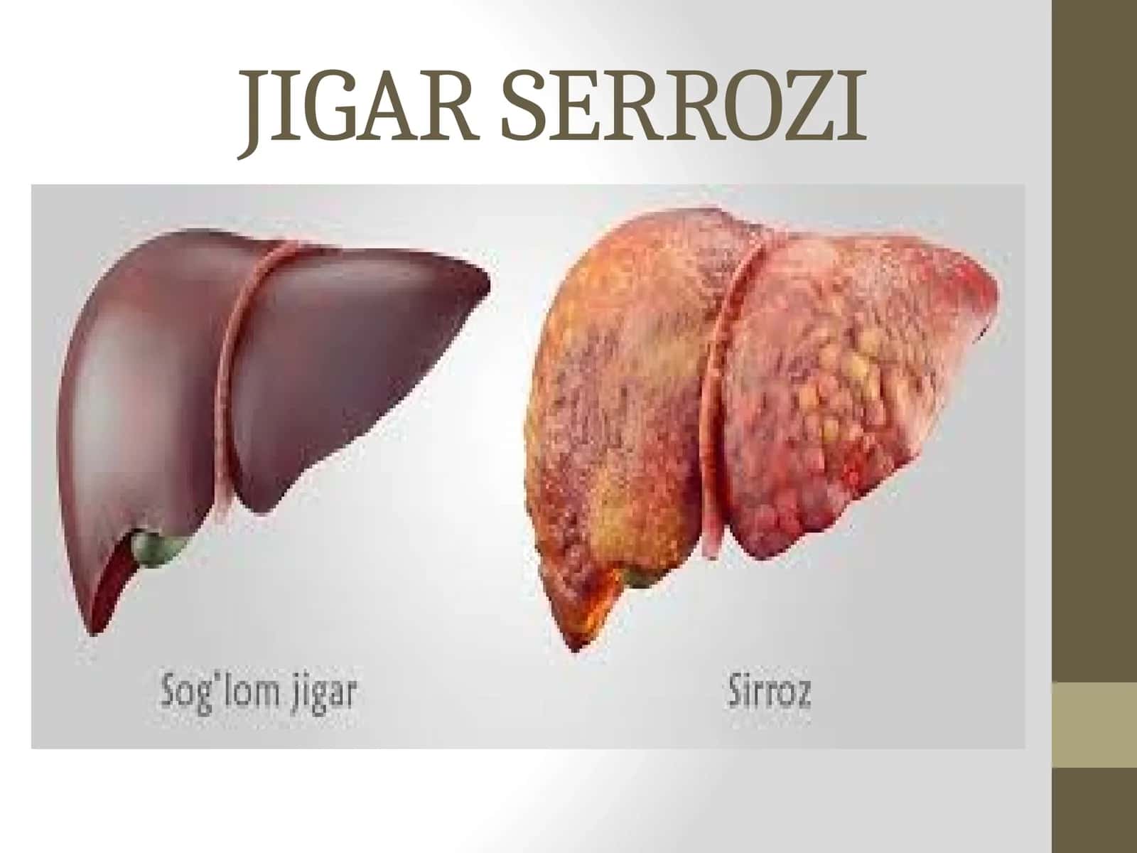 JIGAR SERROZI