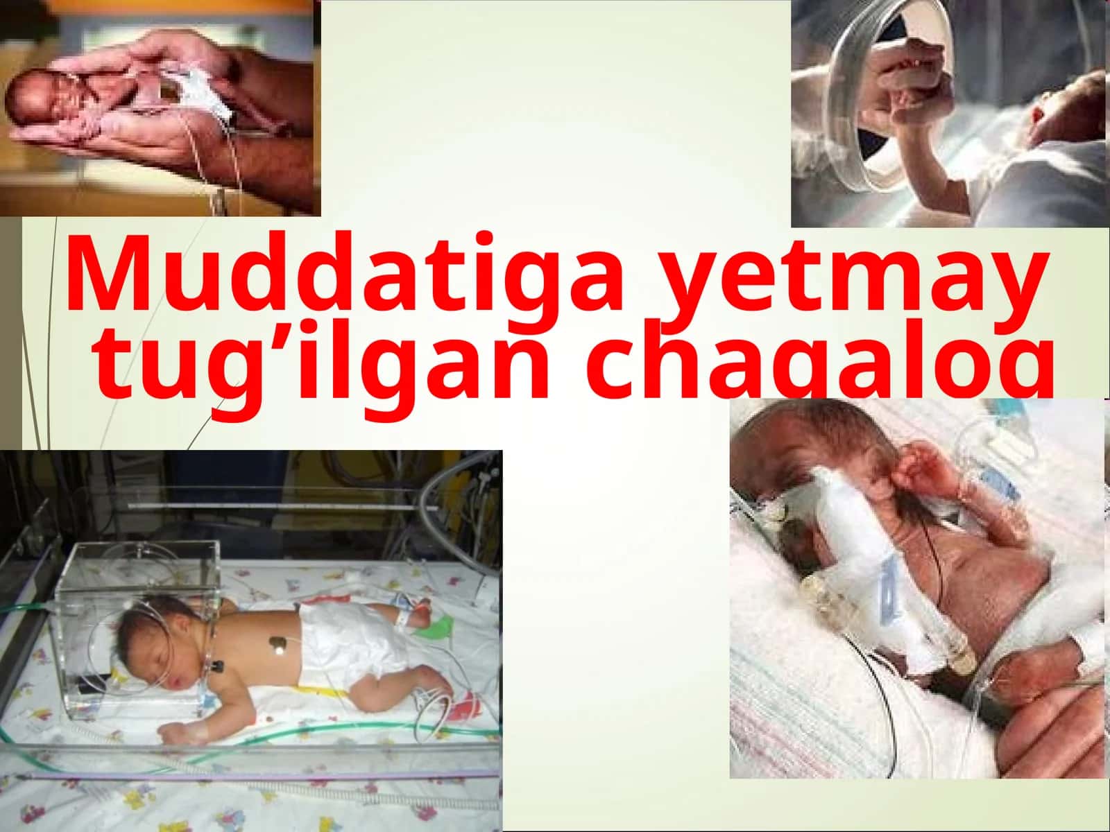 Muddatigayetmay tug’ilgan chaqaloq