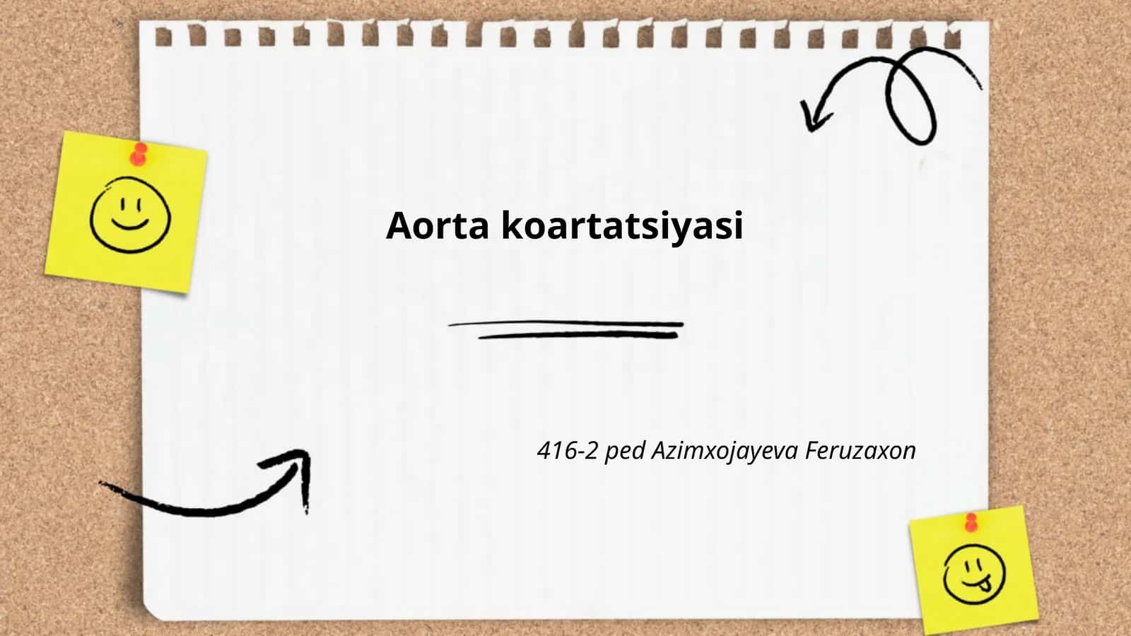 Aorta koartatsiyasi