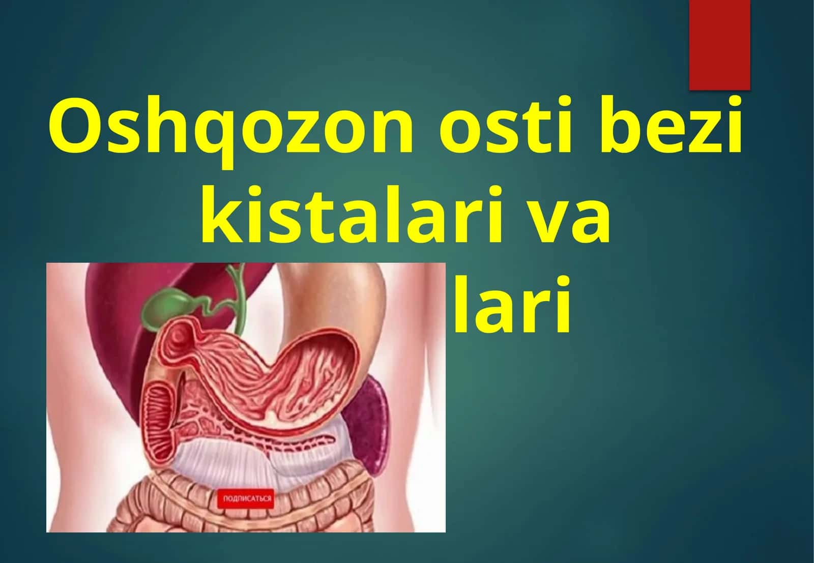 Oshqozon osti bezi kistalari va oqmalari