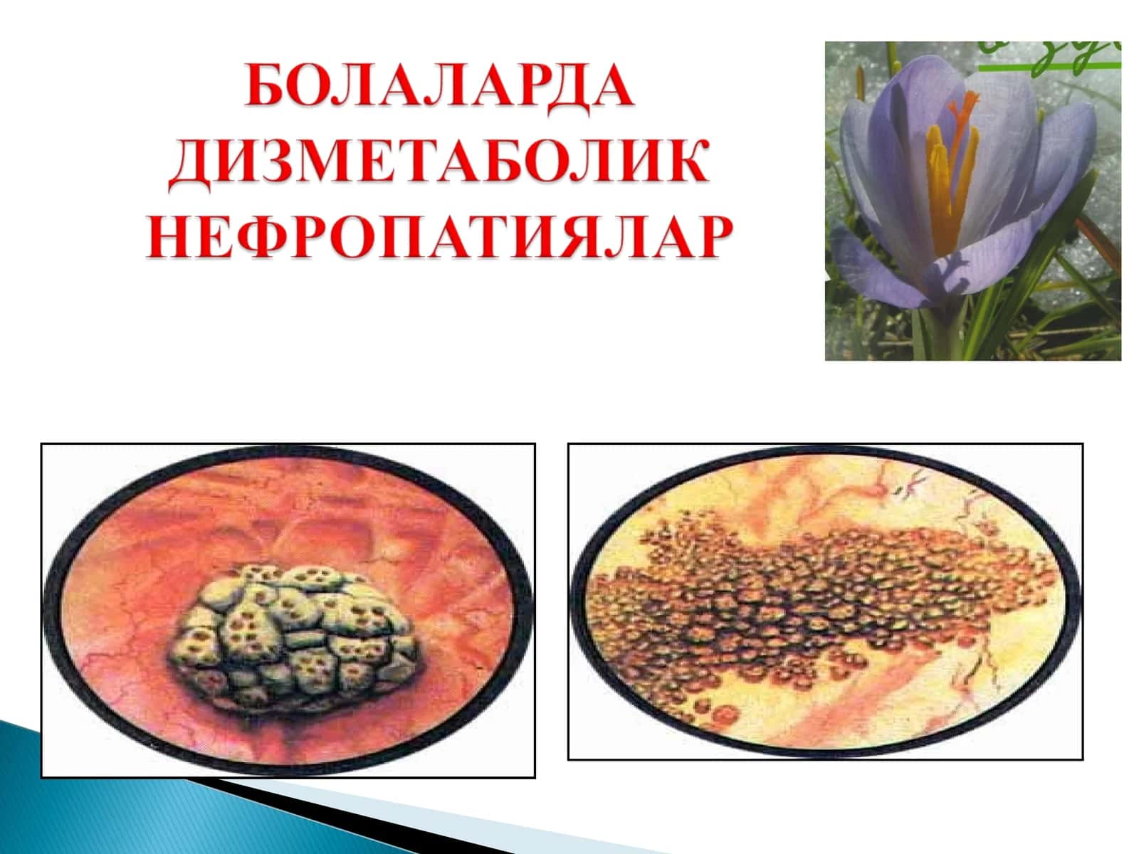 Буйрак касалликлари