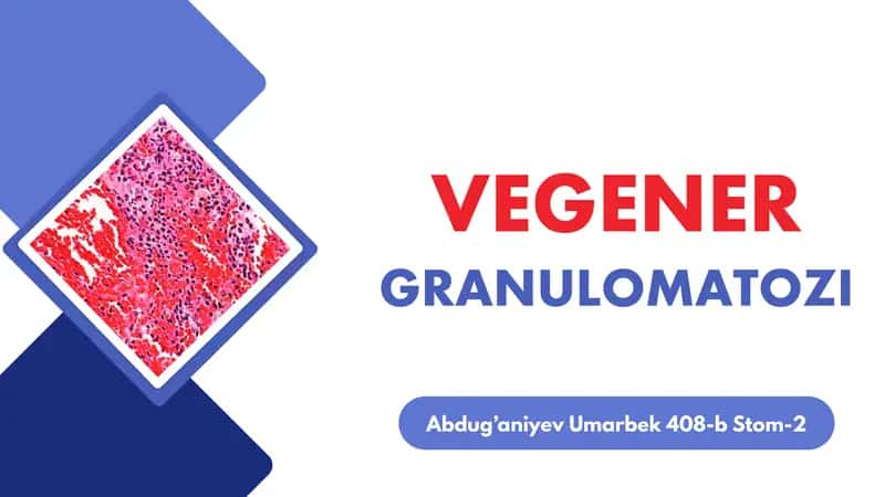 VEGENER GRANULEMATOZ
