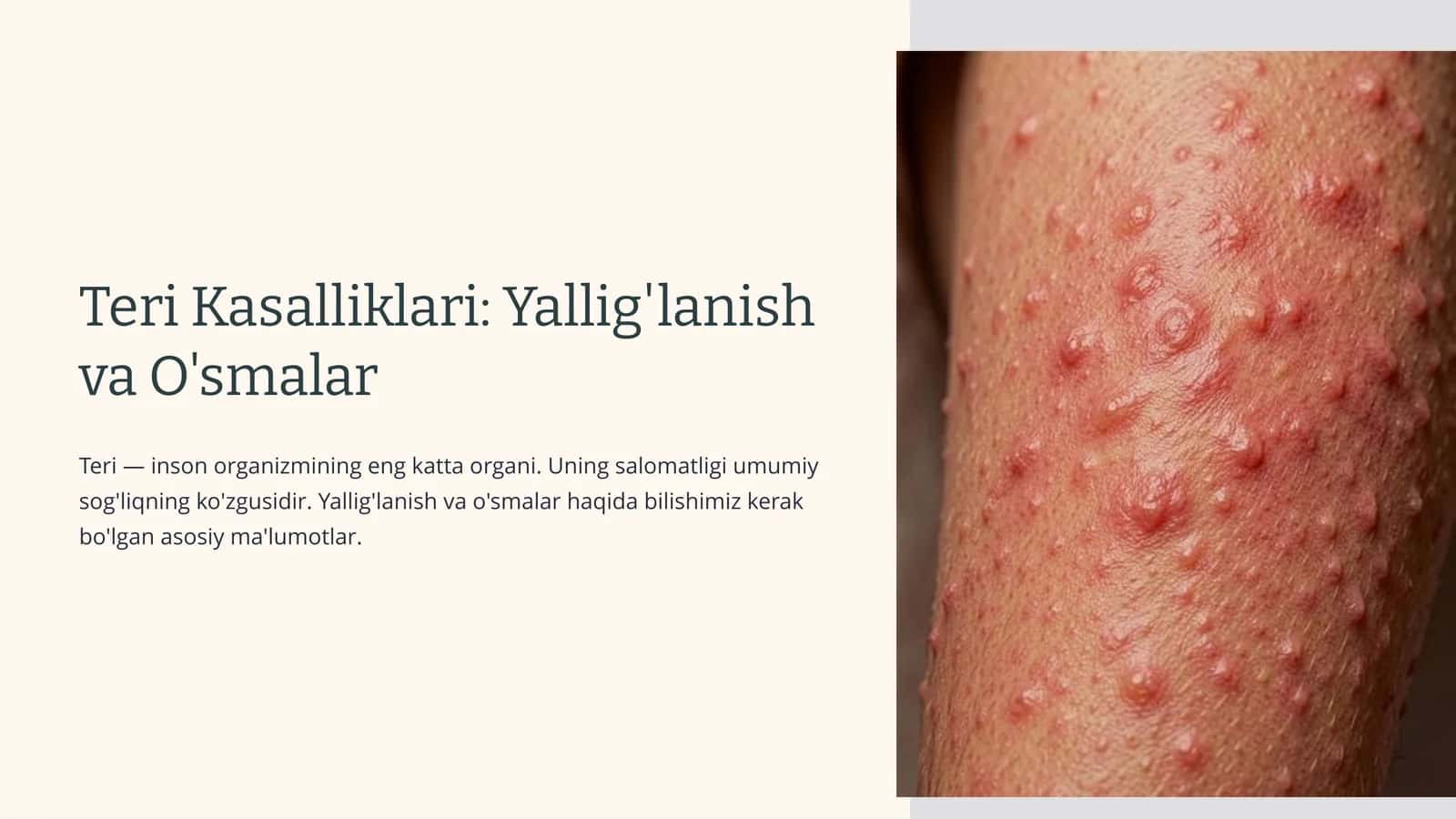 Teri Kasalliklari: Yallig'lanish va O'smalar