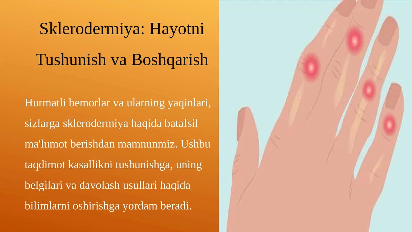 Sklerodermiya: Hayotni Tushunish va Boshqarish