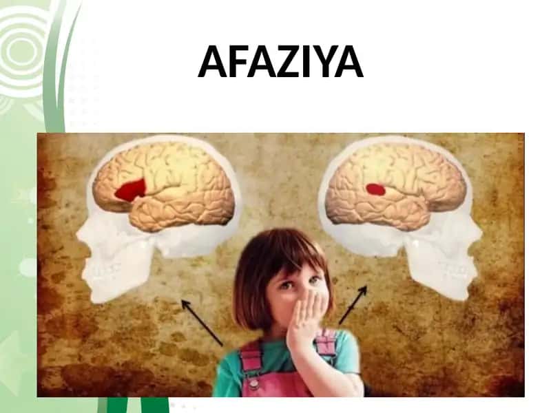 Afaziya