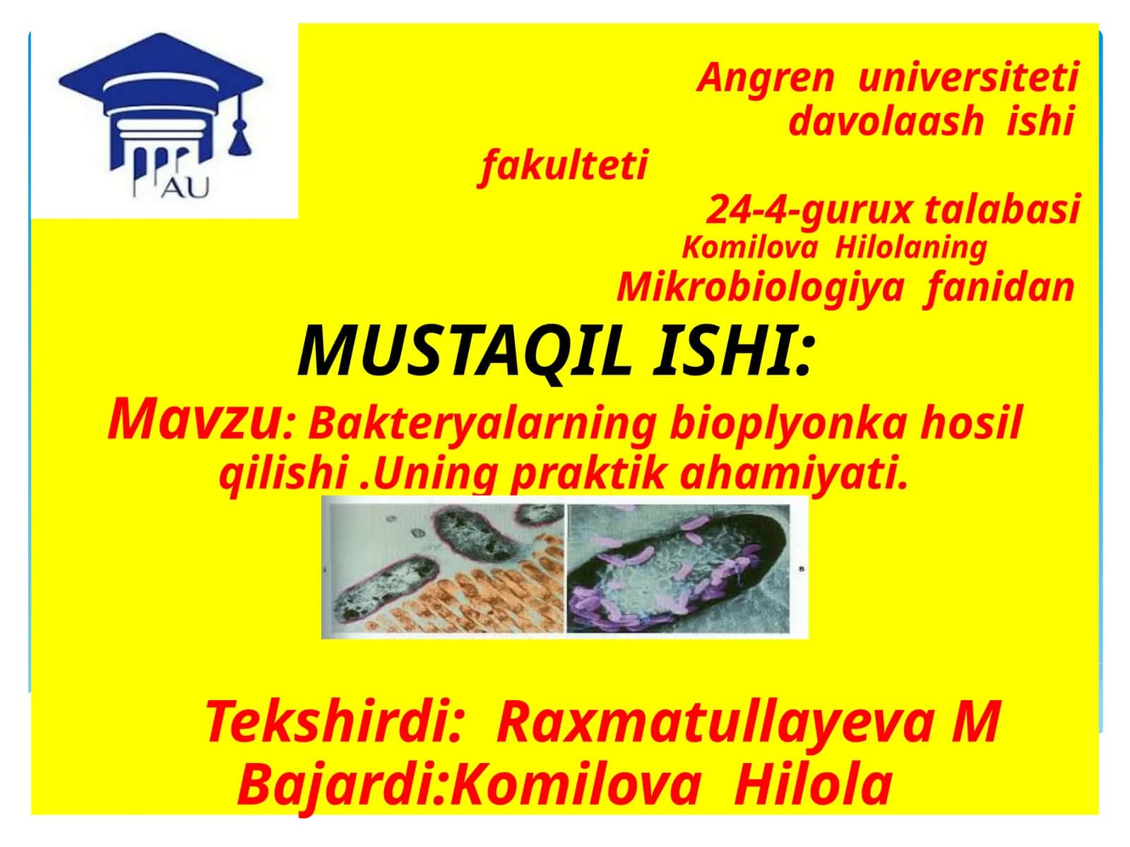 Angren universitetida volaashishi fakulteti 24-4-gurux talabasi Komilova Hilolaning Mikrobiologiya fanidan