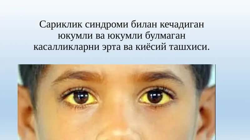 Сариклик синдроми билан кечадиган юкумли ва юкумли булмаган касалликларни эрта ва киёсий ташхиси