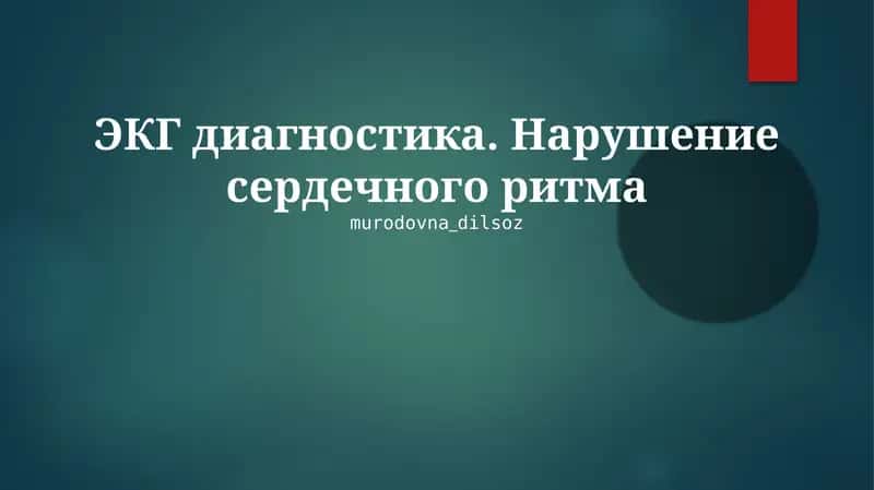 ЭКГ диагностика. Нарушение сердечного ритма