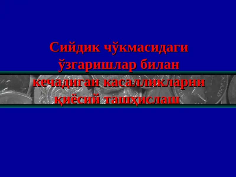 Сийдик чўкмасидаги ўзгаришлар билан кечадиган касалликларни қиёсий ташҳислаш