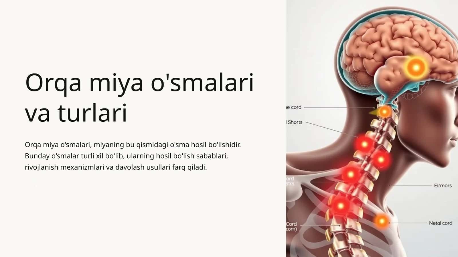 Orqa miya o'smalari va turlari