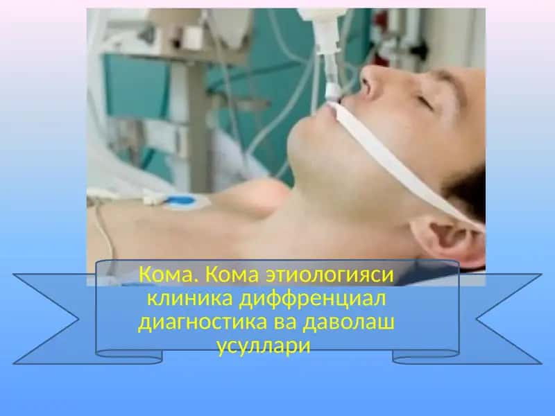 Кома этиологияси клиника диффренциал диагностика ва даволаш усуллари