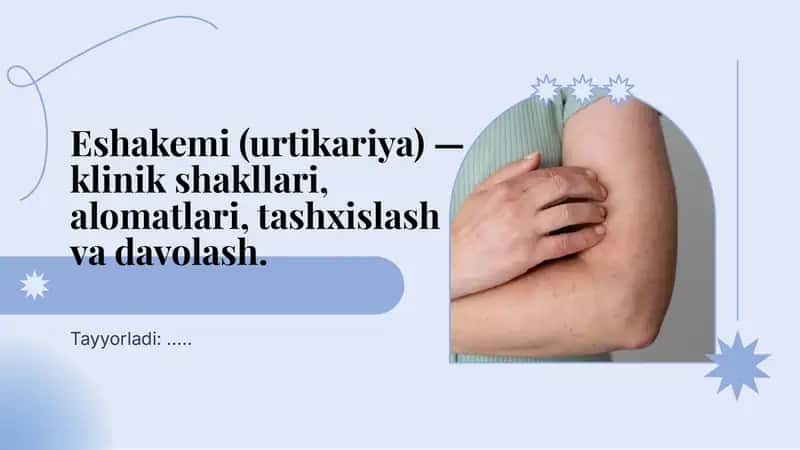 Eshakemi-urtikariya
