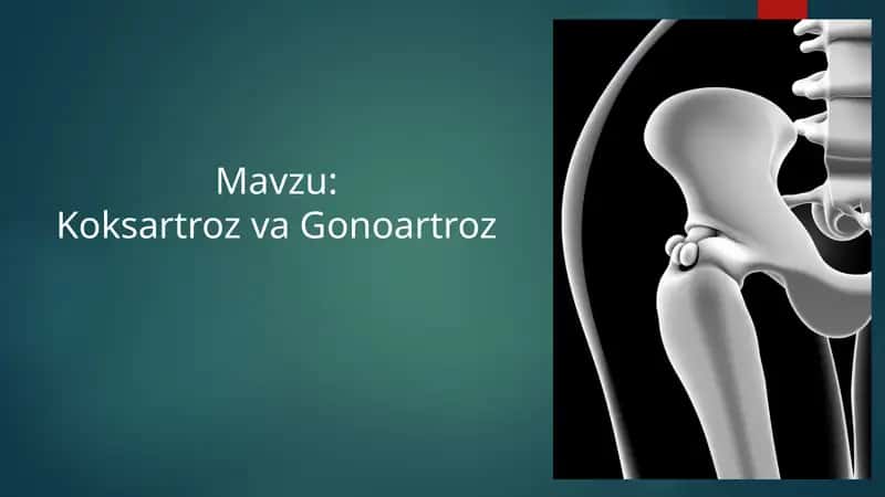 TOS-SON BO'G'IMI ANATOMIYASI Koksartroz va Gonoartroz