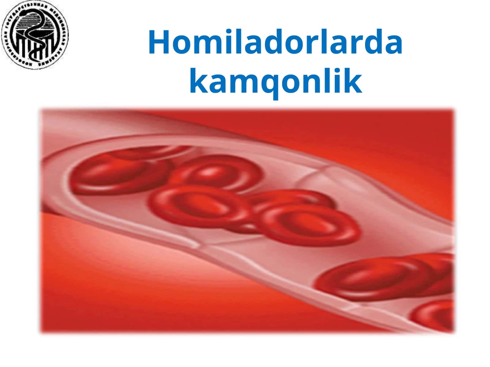 Homiladorlarda kamqonlik